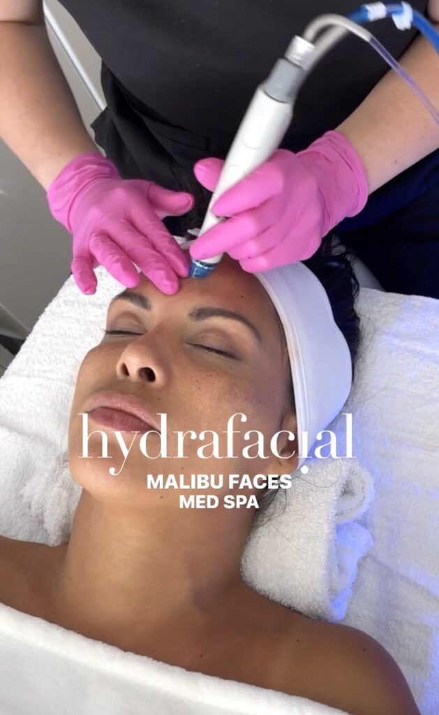 Hermosa Beach Hydrafacial